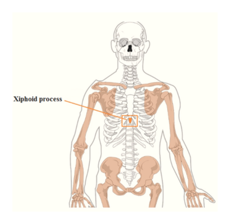 Where Is Xiphoid Process Located