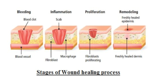 Stages Of Wound Repair