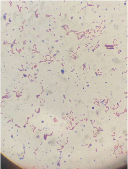 Gram-positive bacteria Essays