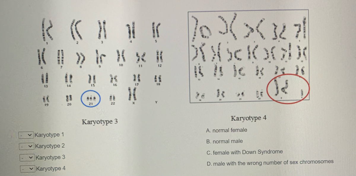 answered-10-11-is-16-17-18-19-20-21-y-karyotype-bartleby