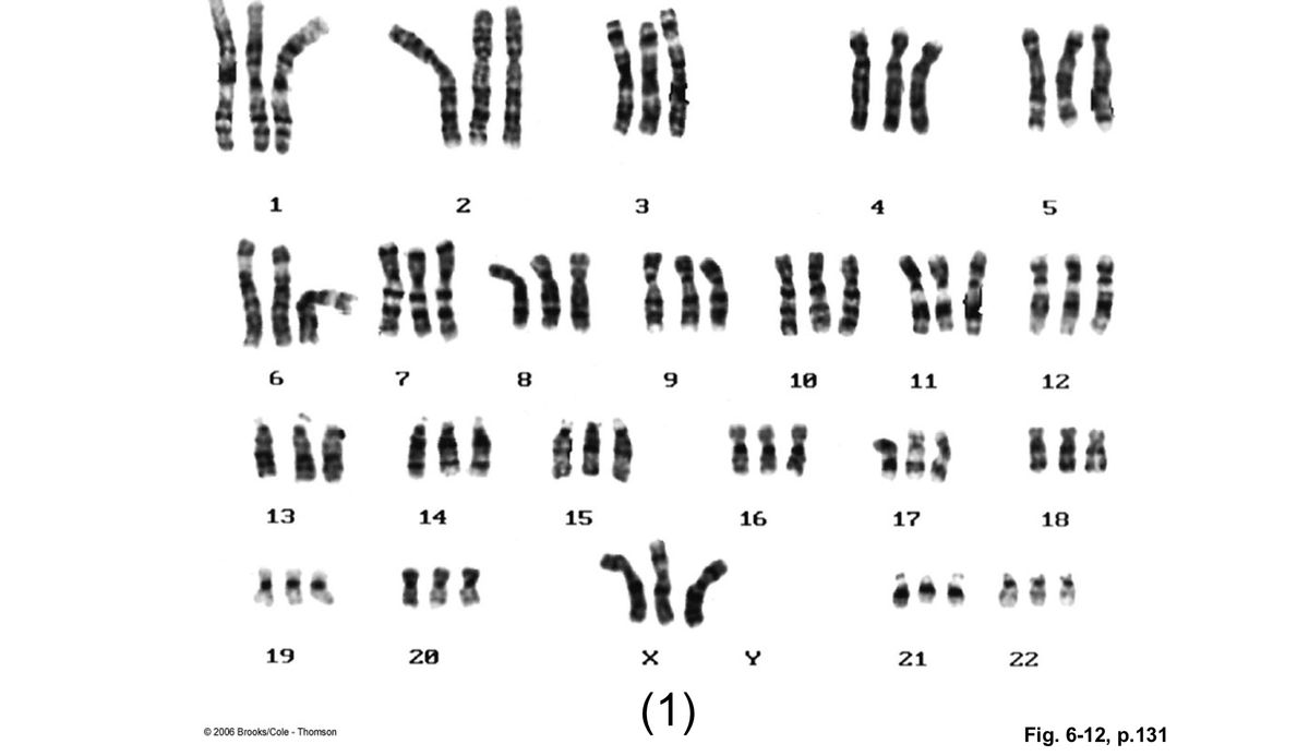 Answered: Analyze the karyotype shown. Indicate… | bartleby