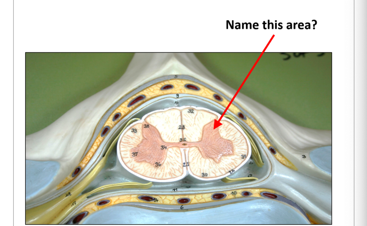 Answered: Anatomy And Physiology Question | Bartleby