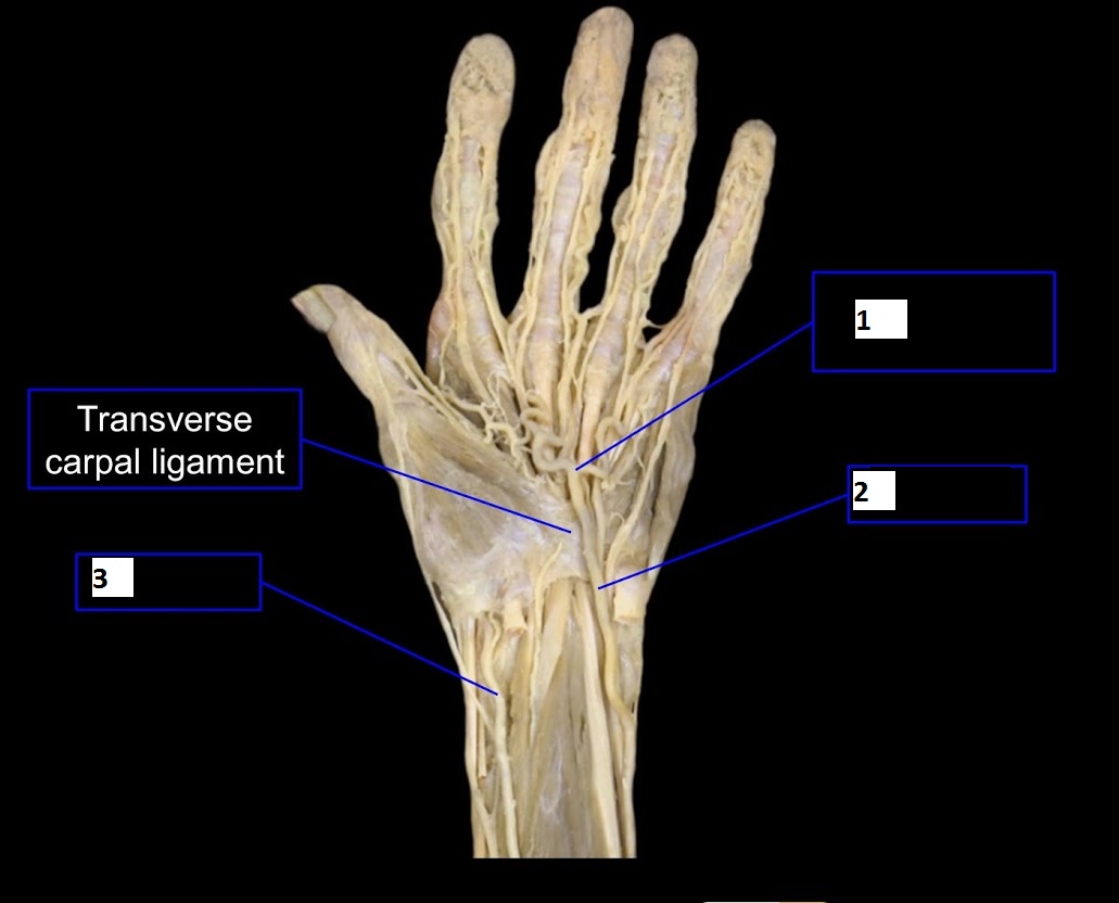 Answered: 1 Transverse carpal ligament | bartleby