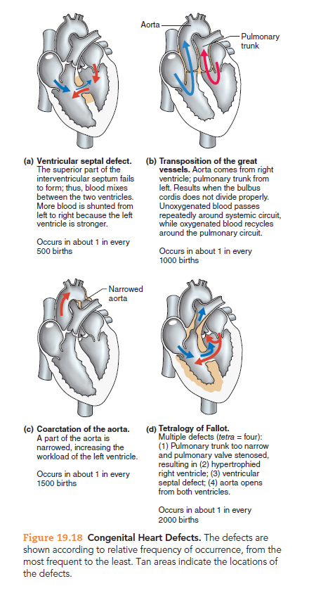 Answered: Aorta Pulmonary trunk (a) Ventricular… | bartleby