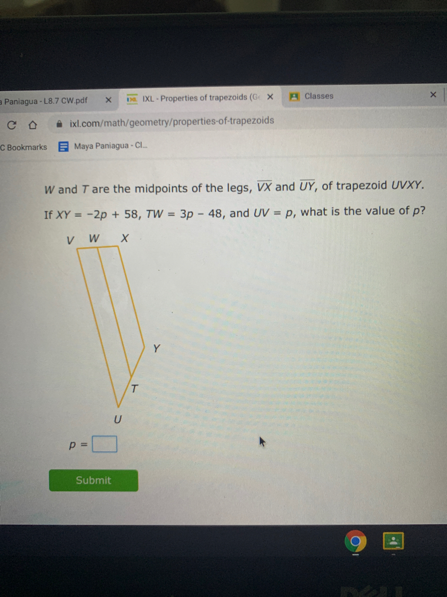 Answered W And T Are The Midpoints Of The Legs Bartleby