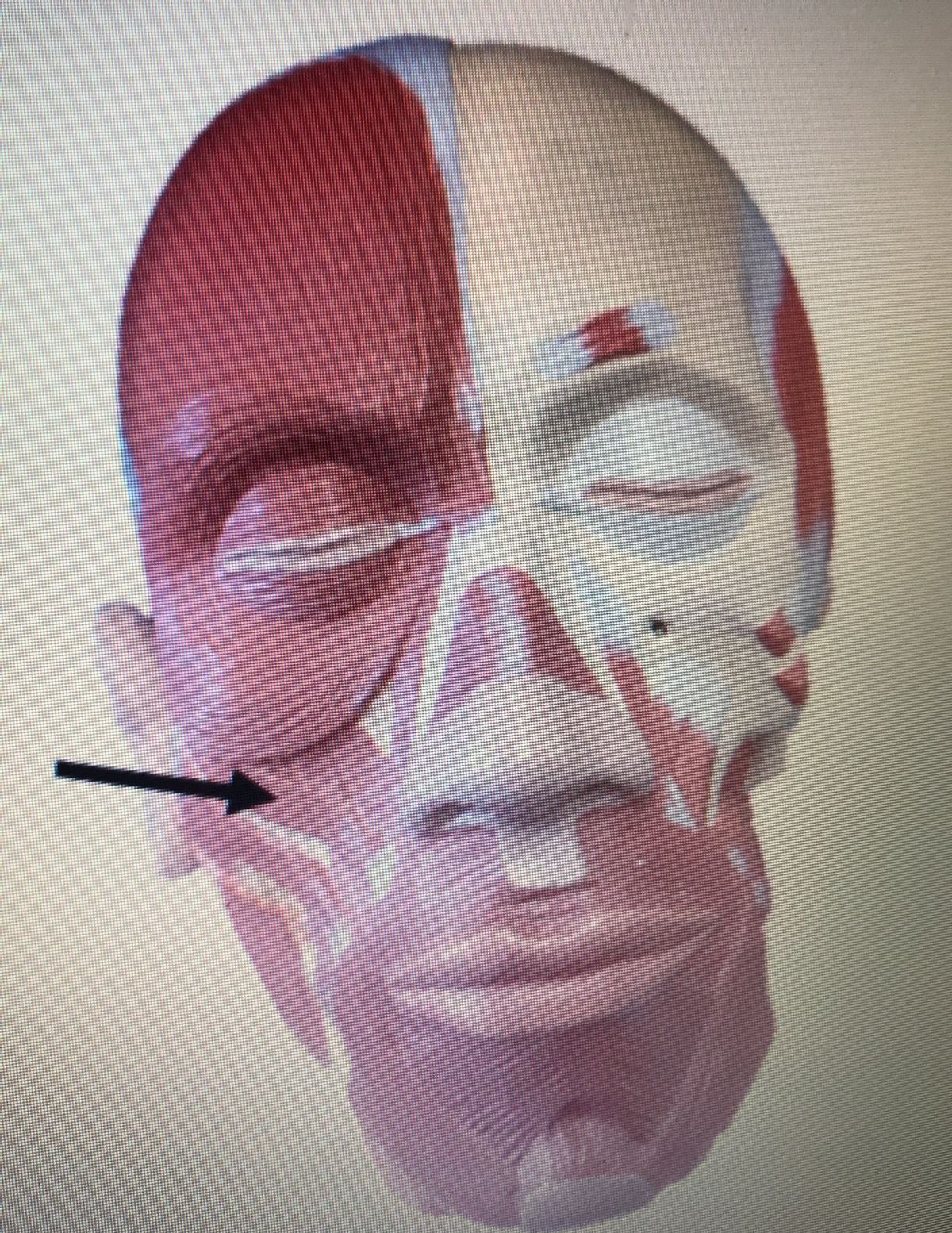 Answered: name the structure. a. masseter b.… | bartleby