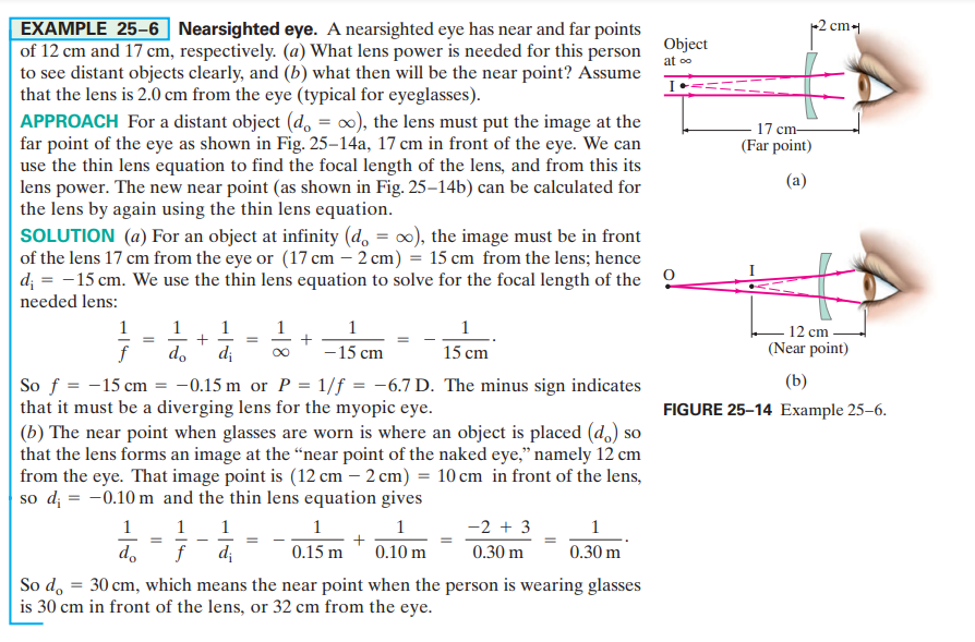 Answered Example 25 6 Nearsighted Eye A Bartleby