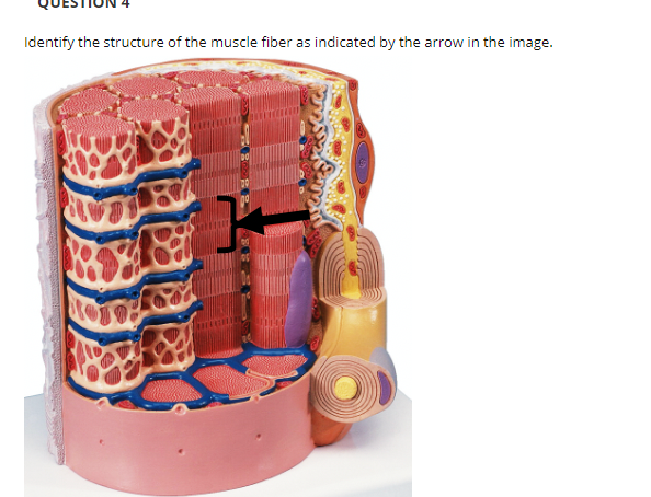 Answered: Identify the structure of the muscle… | bartleby