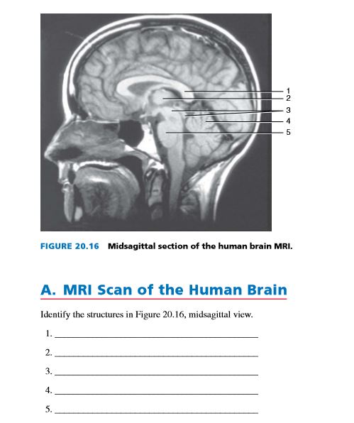 Answered: FIGURE 20.16 Midsagittal Section Of The… | Bartleby