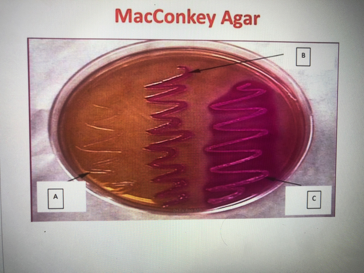 Answered: MacConkey Agar B C. | Bartleby