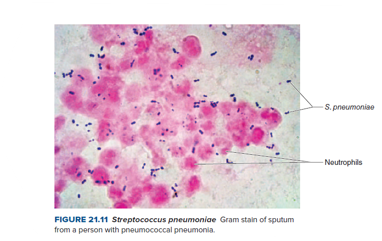 Neutrophils Gram Stain